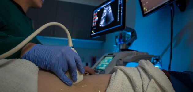 سونوگرافی کلیه