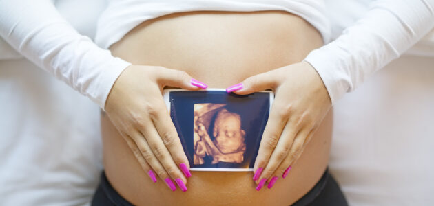 سونوگرافی 4 بعدی