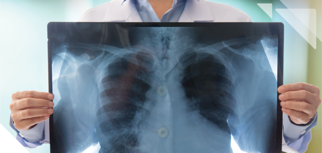 رادیولوژی ریه و دستگاه تنفسی