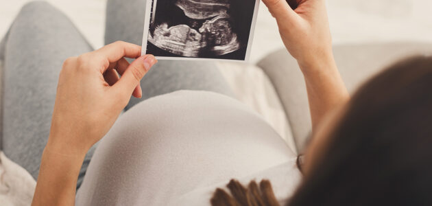 سونوگرافی زمان بارداری