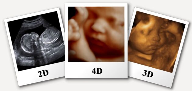 سونوگرافی چند بعدی