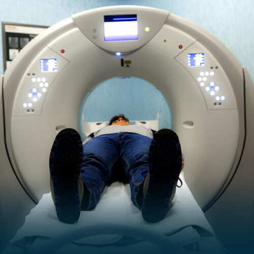 رادیوگرافی دیجیتال