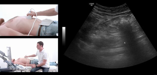 سونوگرافی پانکراس