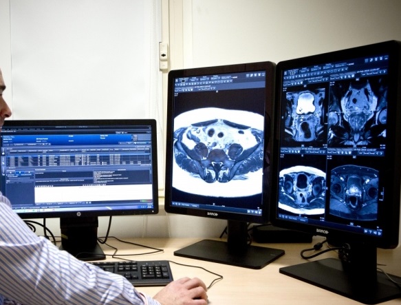 رادیولوژی قفسه سینه